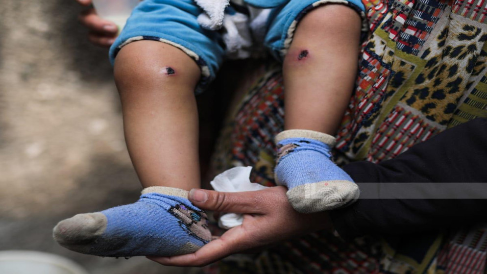 غزة: الاحتلال يخطف طفلا ويعيده بأقدام محروقة