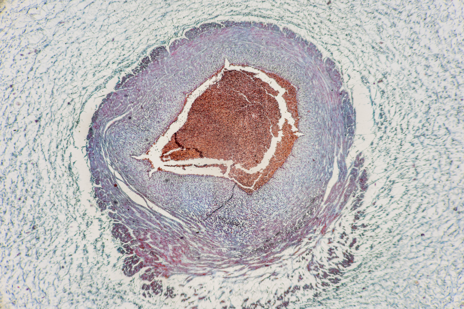 اكتشاف خلايا جديدة أثناء الحمل قد تغير فهمنا لمخاطر التعاطي