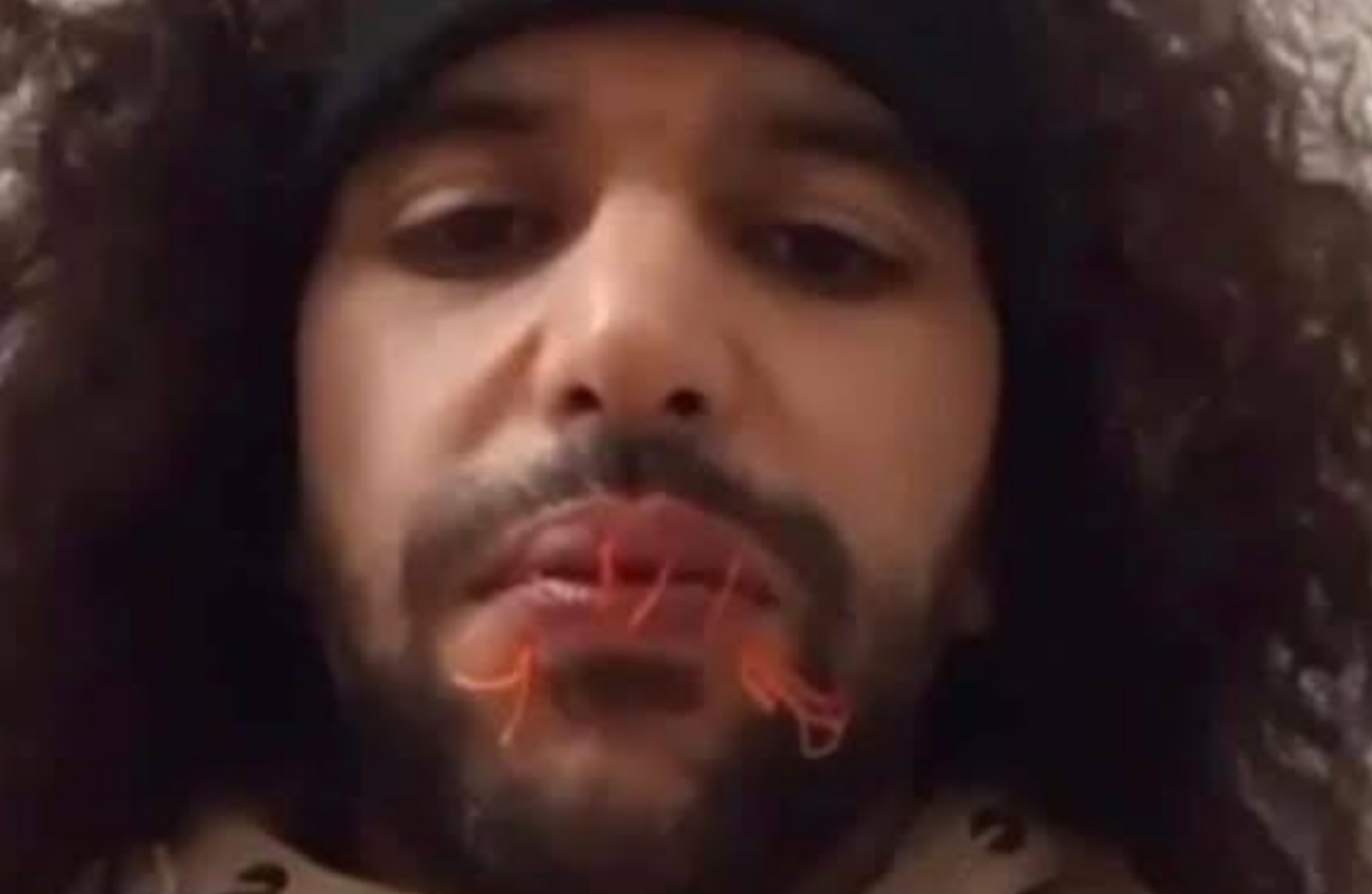 سجين ليبي في إيطاليا يخيط فمه احتجاجا على ظروف احتجازه