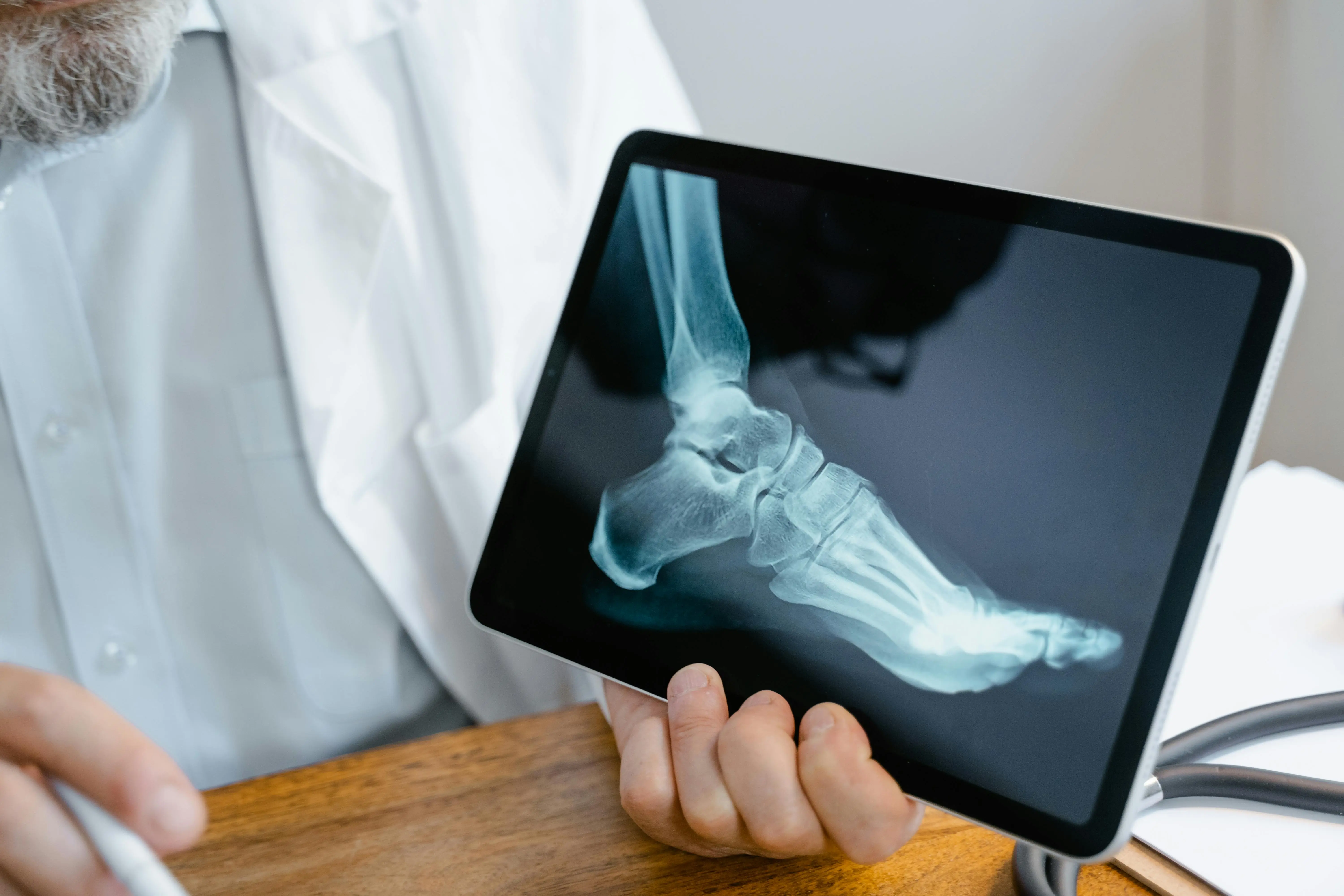 استخدام الصوف كبديل مستدام للكولاجين في ترميم العظام