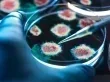 وفاة فنية مختبر بالطاعون في سيبيريا واستنفار صحي لاحتواء الاصابات