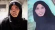 جحيم غزة واقع مرير من التشوهات الجسدية وفقدان سبل العيش