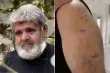 تفاصيل صادمة لاعتداء مستوطنين على مسن فلسطيني في نابلس