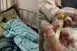 تزايد حالات الحمى الشوكية بين اطفال غزة في ظل انهيار المنظومة الصحية